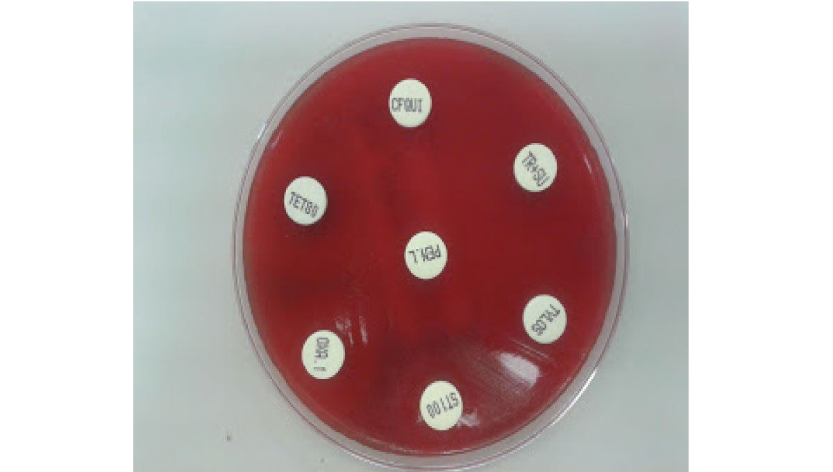 ODPORNOST MIKROORGANIZMOV PROTI ANTIBIOTIKOM IN MASTITIS